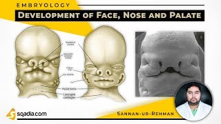 Development of Face Nose and Palate  Embryology Lectures  Medical Student  VLearning [upl. by Lerrej443]