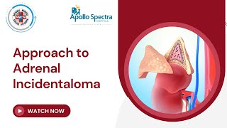 Approach to Adrenal Incidentaloma [upl. by Avrit]