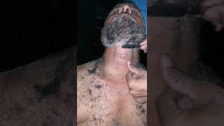 Husband Haircut Dandruff old flake very bad condition😱😳 dandruff removal satisfyingpart13 [upl. by Yadrahs]