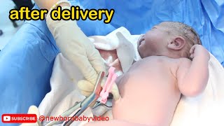 Newborn baby care after leaving the moms womb 😍 afterbirth babyborn [upl. by Omsare]