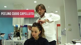 Peeling cuoio capelluto [upl. by Allegra368]