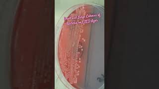 Small and Large Colonies of Bacteria on CLED agar Demonstration [upl. by Yesiad]