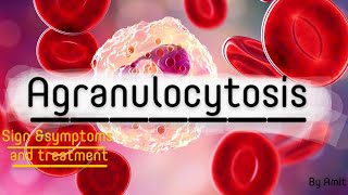 Agranulocytosis sign ampsymptoms and its treatment blood disorder MSN 1st bsc nursing 2nd year [upl. by Leda]