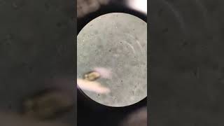 Giardia in a fecal float  Veterinary Video [upl. by Mallina]