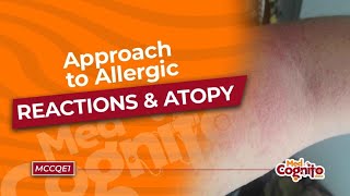 Approach to Allergic Reactions amp Atopy  MCCQE1 [upl. by Jaworski569]