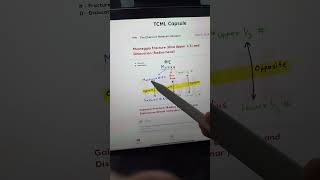 Forearm bone fractures neetpg inicet fmge [upl. by Alexandra]