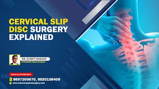 Cervical Slip Disc Surgery Explained  Dr Susmit Naskar  Orthopedic Spine Surgeon [upl. by Eendys897]