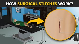 How Stitches Work In Body 3D Animation  Healing Process Of Surgical Wounds [upl. by Maggio]