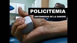 ¿SABES QUÉ ES LA POLICITEMIA VERA [upl. by Josephson432]