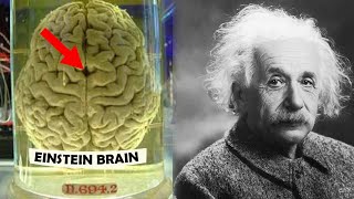 How Einsteins Brain was Different [upl. by Ahseenak]