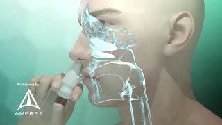 Fluticasone nasal spray Flonase  3D medical animation [upl. by Barrett]