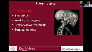 Cervical Disc Disorders with Radiculopathy and Surgical Options  Traumatic Spinal Cord Injury [upl. by Ahseikal]