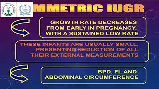 IUGR  Prof Dr Syed Amir Gilani [upl. by Amitie]
