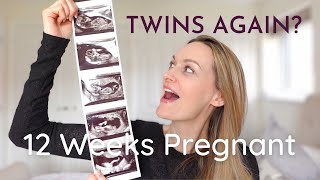 12 WEEKS PREGNANT 2 SETS OF TWINS ULTRASOUND  My Signs amp Symptoms  Pregnancy Update [upl. by Bogart515]