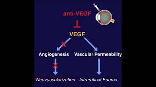 AntiVEGF for the treatment of Retinal Diseases  ANCHOR MARINA BRAVO CRUISE DRCR Protocol I [upl. by Ferrell]