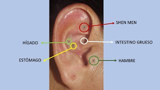 Auriculoterapia para Bajar de Peso ¿Cómo funciona Dr Ricardo Vargas H [upl. by Akimet]