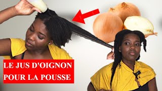 LE JUS DOIGNON POUR LA POUSSE DES CHEVEUX  TEST amp AVIS [upl. by Niuqram]