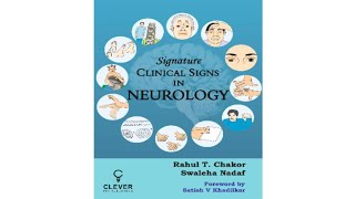 Signature Signs in Neurology Chapter 55 video 3 Opsoclonus Myoclonus Ataxia syndrome OMAS [upl. by Maker]