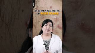 Dermatologist recommends best creams for acne scars  Acne scar treatment  shorts acnescars [upl. by Assirol]