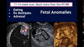 AIUM Webinar Systematic Evaluation of the 1114 Week Fetus Touching on ISUOG Guidelines [upl. by Fitton75]