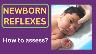 Newborn reflexes  8 vital reflexes of infants [upl. by Nesyt]