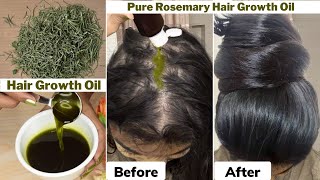 I used👆🏼this Rosemary Hair Growth Oil on Thinning Hair amp Bald ScalpGot 10 times Thick Hair Growth [upl. by Adalia]