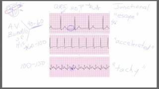 Junctional Rhythms [upl. by Ardnahc]