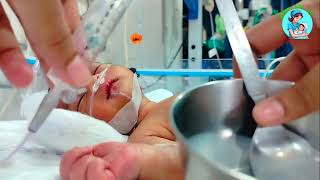 Og Tube feeding  Og Tube Feeding For Newborn  Tube Feeding procedure  NICU viralvideo new cute [upl. by Byrom472]