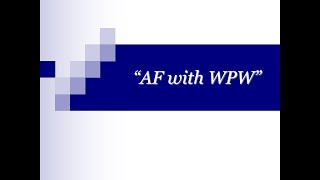 ECG Tip 22 What about AF with WPW [upl. by Aicatsanna]