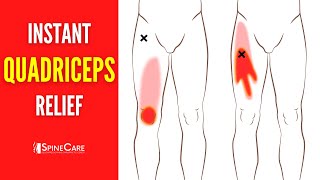 How to Fix Quadriceps Pain FOR GOOD [upl. by Bekelja]