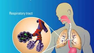 Recognition of Fungi and Activation of Immune Response [upl. by Havens310]