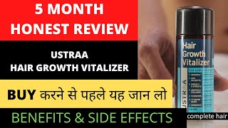 जानिए पूरा सच  Ustraa Hair Growth Vitalizer 100 Real 5 Month use review  BIG FIT [upl. by Blackmun287]