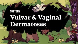 Vulvar amp Vaginal Dermatoses Full Lesson  Sketchy Medical  USMLE Step 2 CK [upl. by Mccollum]