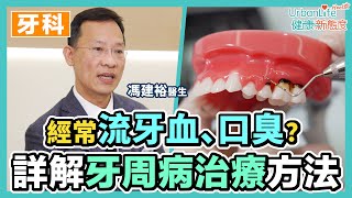 【牙周病治療方法】流牙血、口臭小心牙周病纏身 嚴重或需麻醉手術處理｜UrbanLife Health 健康新態度 [upl. by Nivel]