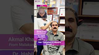 Amazing Hair Transplant Transformation 😲 8Months Results  100 Natural Hairline 🌟  Dr Habib [upl. by De Witt512]