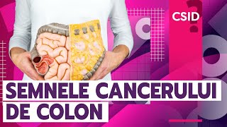 Cancerul de colon 10 semne care să te îngrijoreze [upl. by Yv253]