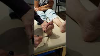 Video 537 Plantar Reflex Test [upl. by Popelka178]