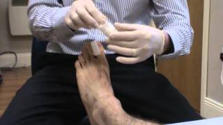 video 35 Toenail Dressing [upl. by Kilam]