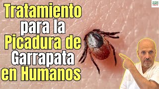 🚨 PICADURA DE GARRAPATA EN HUMANOS TRATAMIENTO MÁS EFECTIVO 🚨 [upl. by Honora]