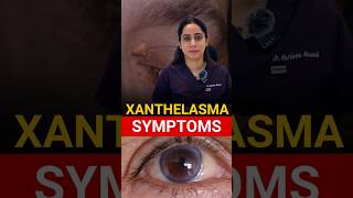 Most Common Symptoms Xanthelasma [upl. by Pillihpnhoj131]