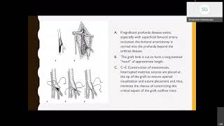 Aortoiliac Disease Open Anatomic Reconstruction [upl. by Wade967]