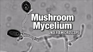 Mushroom Mycelium Under a Microscope [upl. by Bertle]