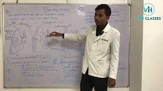 Pneumothorax in hindi  Vaga Hospital Med Class [upl. by Adehsor]