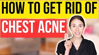 Say Goodbye To Chest Acne With Expert Dermatologist Advice [upl. by Agnesse]