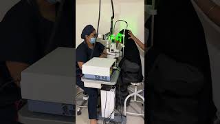 Retinal Laser Surgery Barrage laser in 2 minutes [upl. by Wolford]