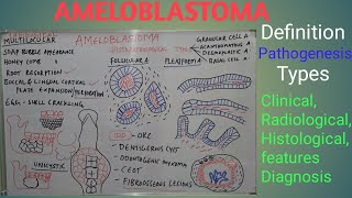 Ameloblastoma  Definition pathogenesis types clinical radiological features and diagnosis [upl. by Saddler]