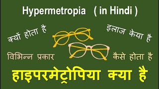 Hypermetropia causes types and treatment in Hindihypermetropia hyperopia longsightedness [upl. by Namijneb]