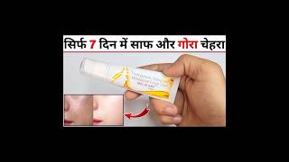 Melacare Cream Review in Hindi मेलाकेयर क्रीम के फायदे नुकसान उपयोग [upl. by Shulem802]