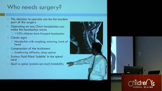 quotChiari Malformation Chiari Decompression and Neurosurgeryquot  Sean D McEvoy MD [upl. by Slaughter897]