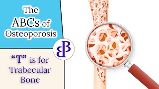 T is for Trabecular Bone  The ABCs of Osteoporosis [upl. by Ozen420]